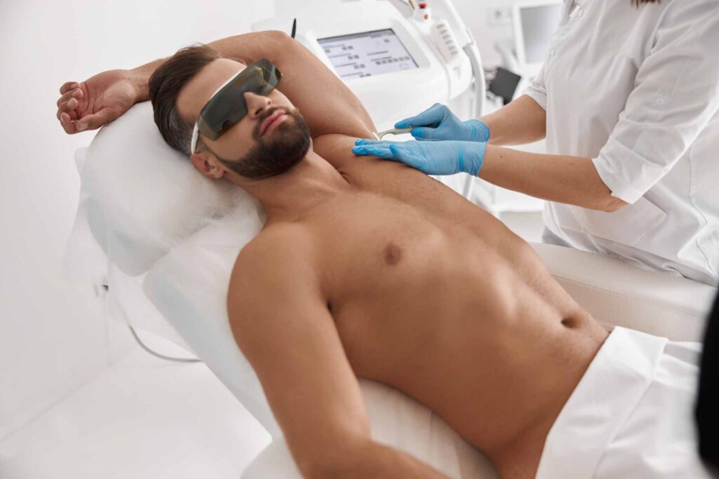 depilazione laser petto
